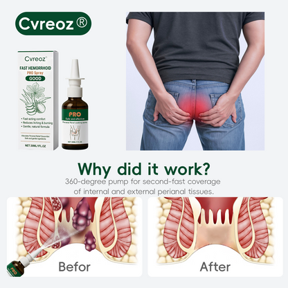 🏅𝙏𝙂𝘼 𝘼𝙥𝙥𝙧𝙤𝙫𝙚𝙙 | Alcuras® Fast Hemorrhoid PRO Spray