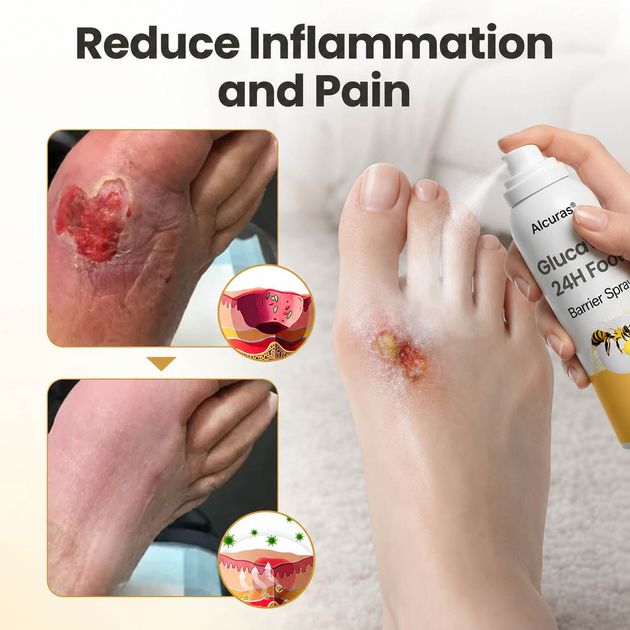 Alcuras® GlucaVeil 24H Foot Barrier Spray