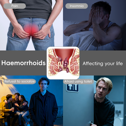 🏅𝙏𝙂𝘼 𝘼𝙥𝙥𝙧𝙤𝙫𝙚𝙙 | Alcuras® Fast Hemorrhoid PRO Spray